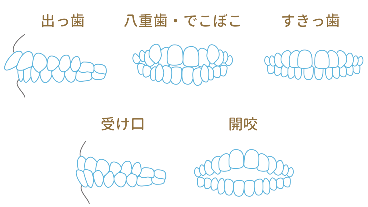 他院で断られた方も ご相談ください - 熊本市矯正歯科相談室