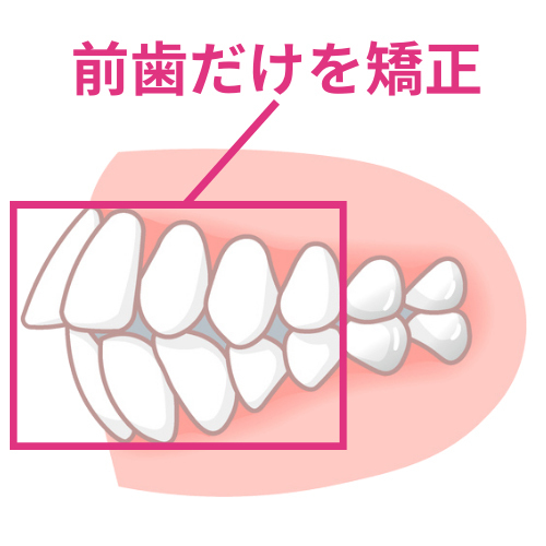 他院で断られた方もお任せ- 熊本市矯正歯科相談室