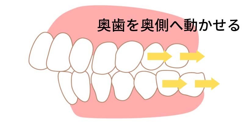 他院で断られた方もお任せ- 熊本市矯正歯科相談室