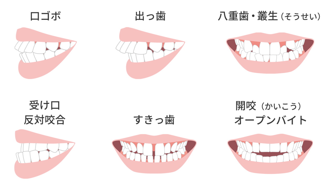 他院で断られた方もお任せ- 熊本市矯正歯科相談室